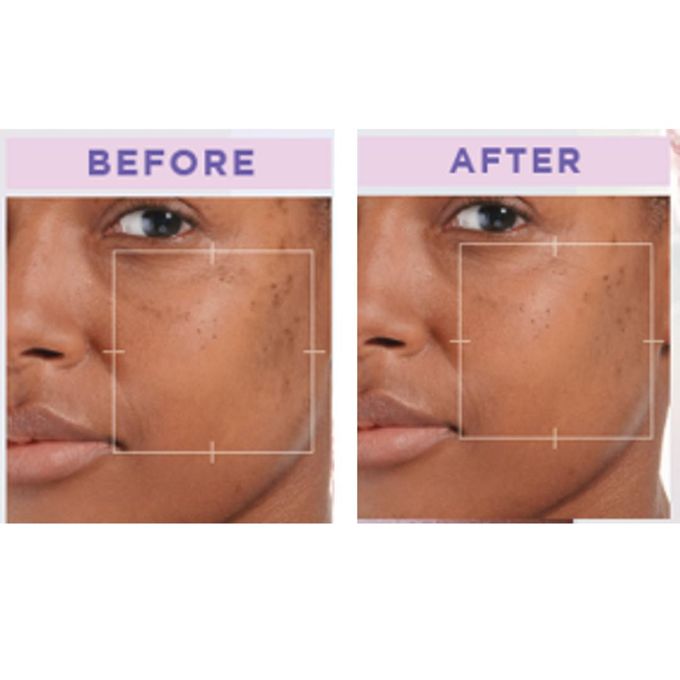 【Discounted】L'Oreal Paris GLYCOLIC BRIGHT FACE CLEANSER FOAM 100ML