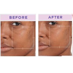 L'Oréal Paris Glycomplete Day & Night Kit, Glycolic Bright Cleanser 100ml, Glycolic Bright Melasyl Serum 30ml, Glycolic Bright Day Cream 50ml, Glycolic Bright Night Cream 50ml