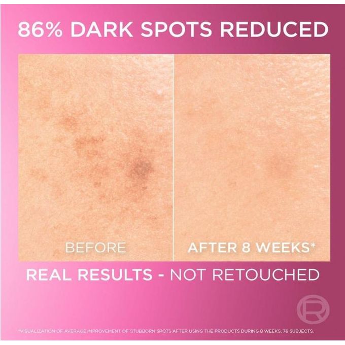 L'Oreal Paris GlycolicBright  Acid Serum 30ml