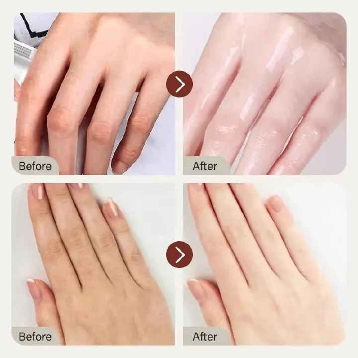 IREV Retinol Hand Cream - with Retinol Gold Collagen - Antiaging Hand Treatment Cream Softens Smoothes Protects Hands Nails Cuticles - For Younger Looking Hands Vitamin A Minimises Age Effect on Skin