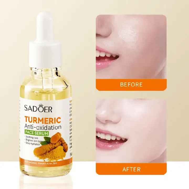 Sadoer Duo Set of Tumeric Anti Oxidation Turmeric Soap Bar + Turmeric Serum Anti Acnes, Like Vitamin C, it is Effective in Acne Removal, Pore Shrinking and Skin Tone Brightening