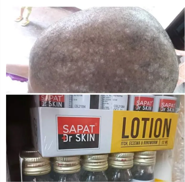 Dr. Skin Sapat Salicylic Acid Skin Lotion for Itch, Eczema & Ringworms