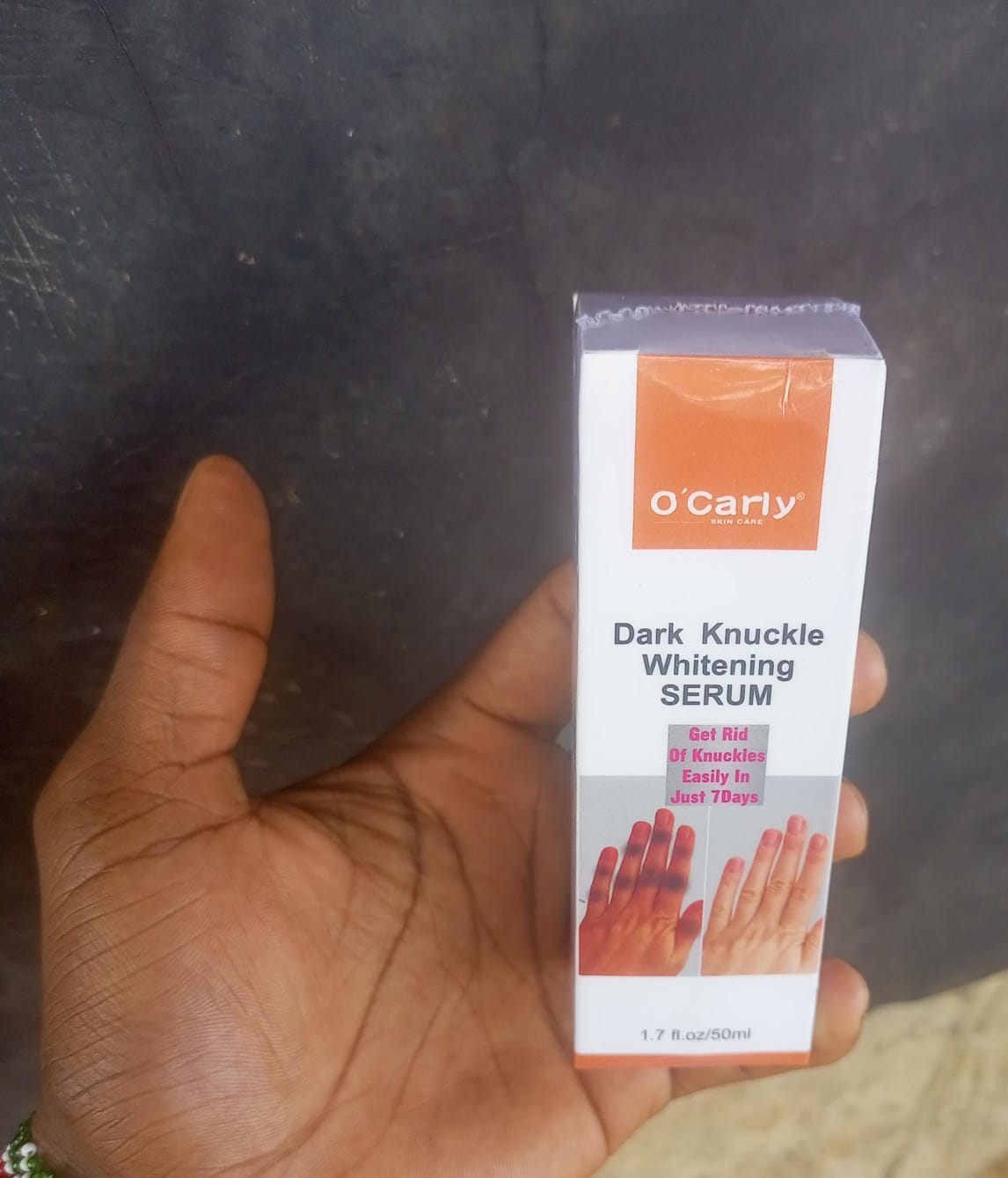 Dark knuckles whitening serum O'CARLY Dark Knuckle Whitening Serum