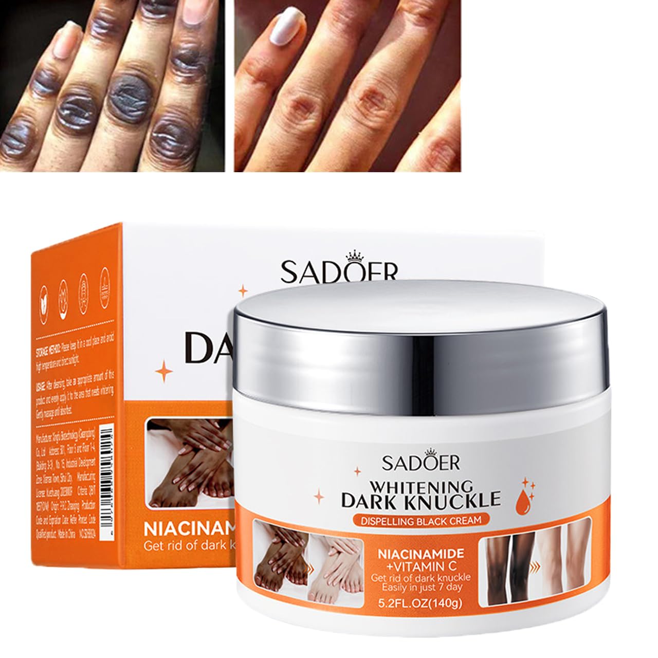 SADOER Whitening Dark Knuckle Removing Dark Spots Knuckle Brightening Cream