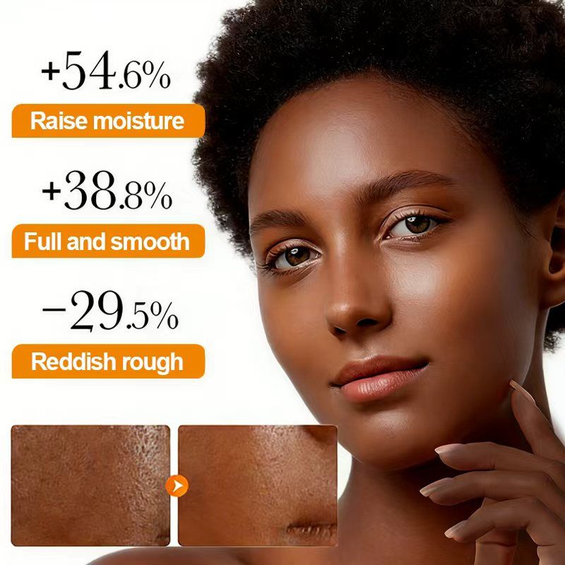 DR.DESS  Turmeric  Face Cream, Anti Oxidation Turmeric Cream , Face Cream For Deep Moisturizing skin Prevents Acnes, Oil Control and Soothing, skin Repair