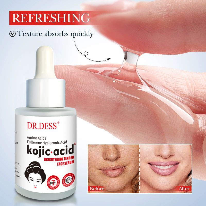 DR.DESS Kojic Acid Face Serum Protects against Acne, Dark Spots, Freckles Reduces Skin Pigmentation and Anti Aging Facial Serum