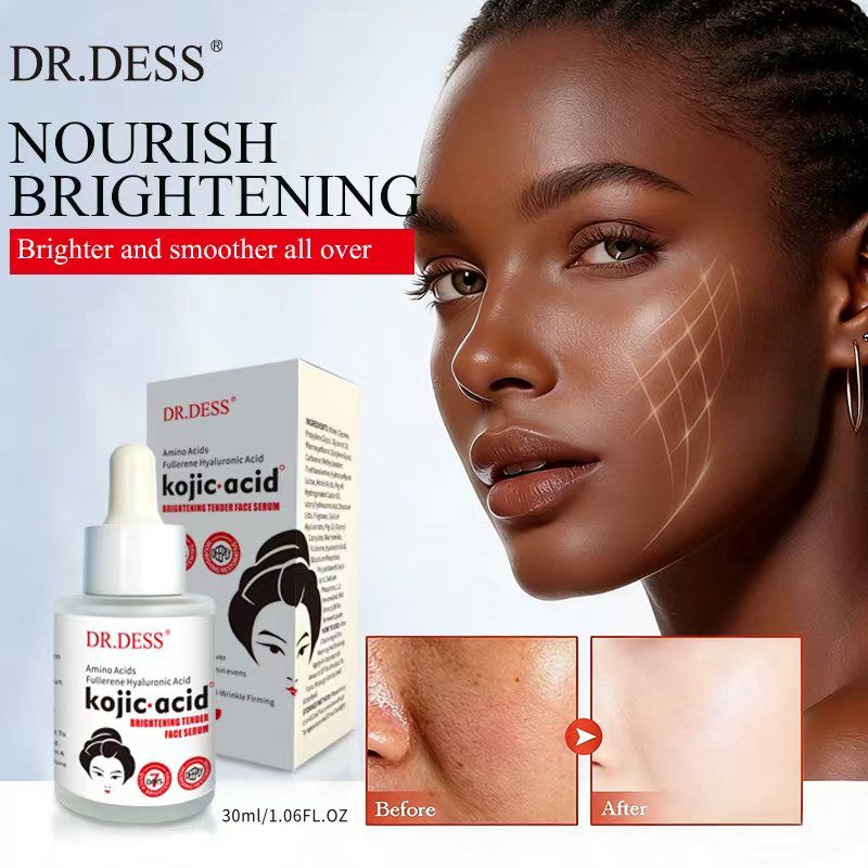 DR.DESS Kojic Acid Brightening Face Serum Protects against Acne, Dark Spots, Freckles Reduces Skin Pigmentation and Anti Aging Facial Serum 30ml