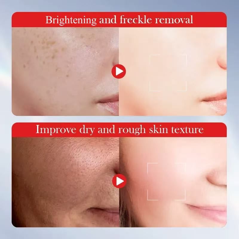 DR.DESS Kojic Acid Brightening Moist Face Cream 50g Skin Lightening Hydrating Anti-Acne Reduces Dark Spots Smooth Nourishing Daily Moisturizer