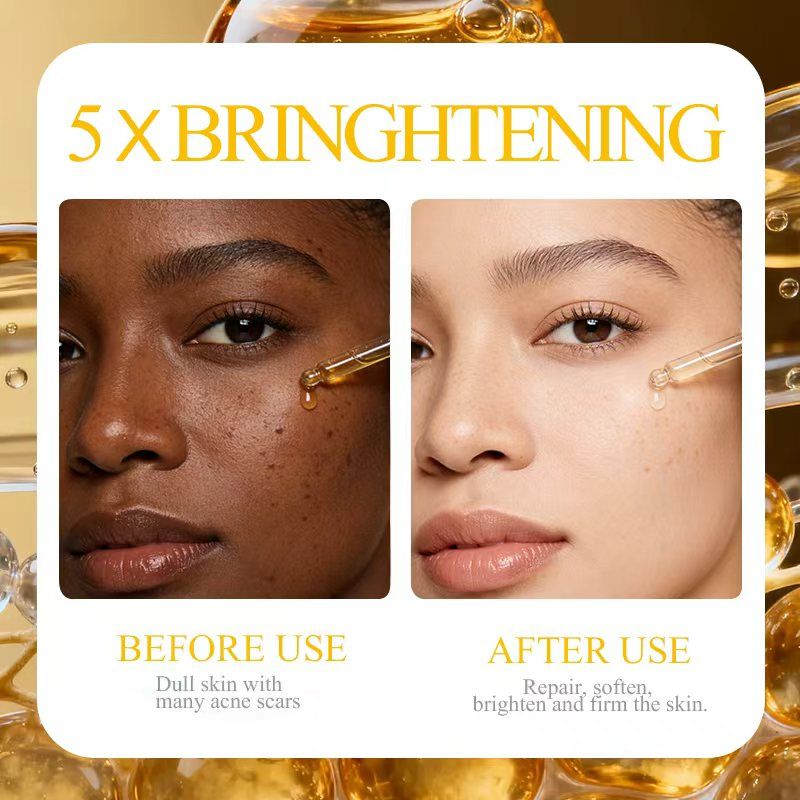 Dr. Dess AHA Brightening Face Serum with Vitamin C, Niacinamide & Hyaluronic Acid, Anti-Acne, Dark Spots Fading, Hydrating, Skin Barrier Repair for Sensitive & Acne-Prone Skin