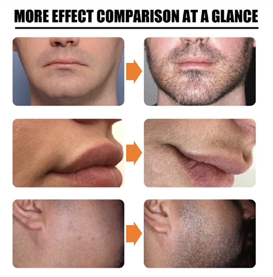 30ml Men Beard Growth Roller Set Beard Growth Kit Men's Beard Growth Essence Nourishing Enhancer Beard Oil Spray Beard Care Set 30ML [分类版本3]