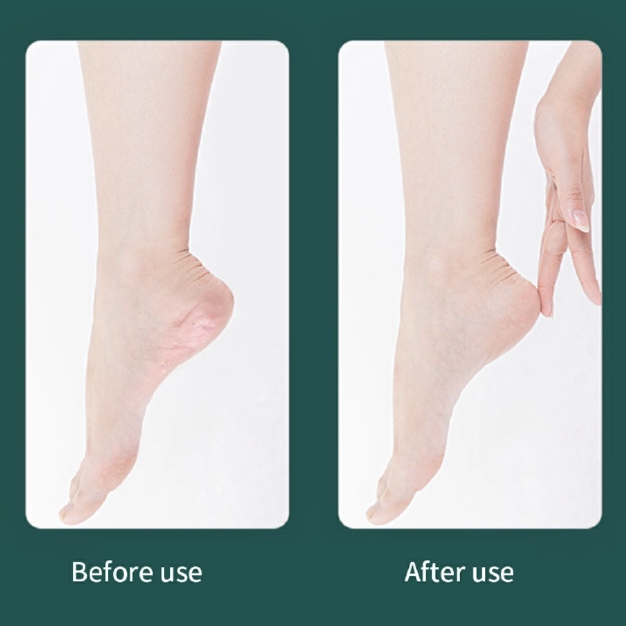 10Pcs Professional Pedicure Tools Set Foot Care Kit Stainless Steel Foot Rasp Foot Dead Skin Remover Callus Clean Feet Care Black 10pcs [分类版本3]