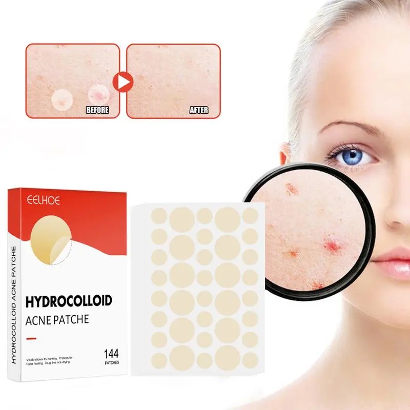 Pimple Patch 144 PCS Mighty Pimple Healing Patches Hydrocolloid Acnes Pimple Patch For Zits Blemishes Spot Stickers Facial Care Transparent 144 pieces/box