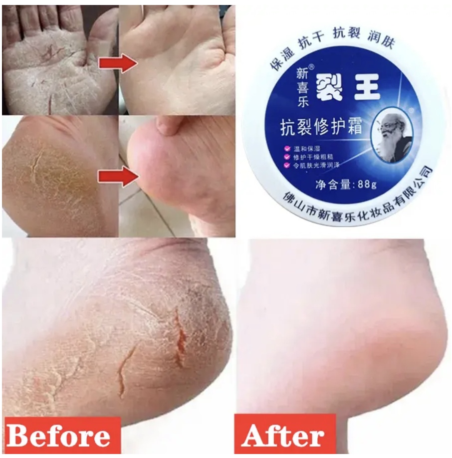Anti-Crack Repair Cream 88g Moisturizing Anti-Dry Hand, Foot and Heel Crack King Cream Face Cream Blue 88g