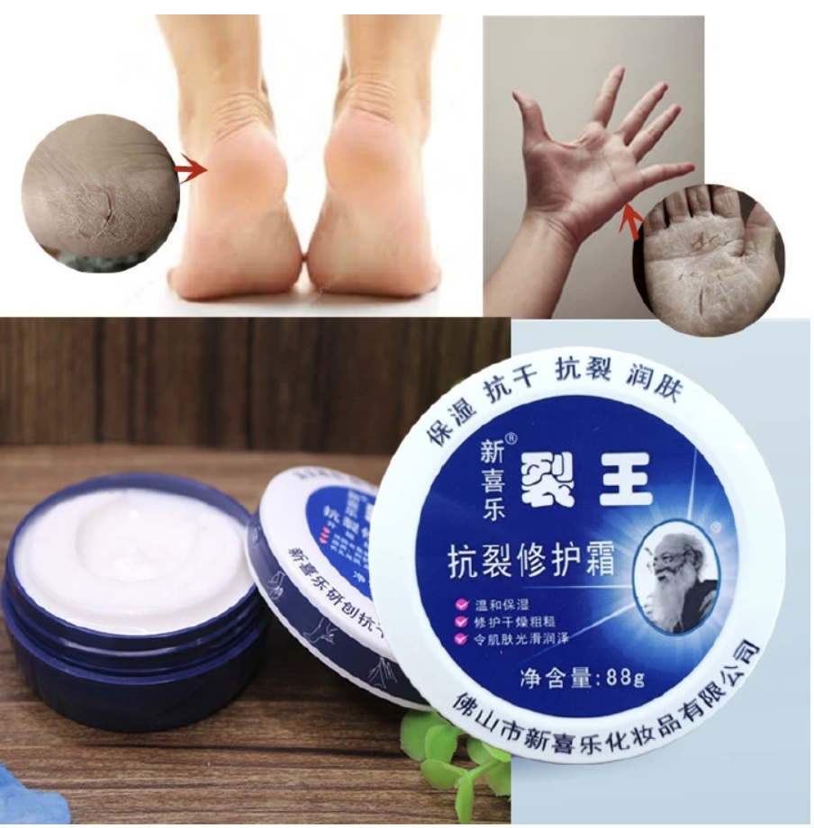 Anti-Crack Repair Cream 88g Moisturizing Anti-Dry Hand, Foot and Heel Crack King Cream Face Cream Blue 88g