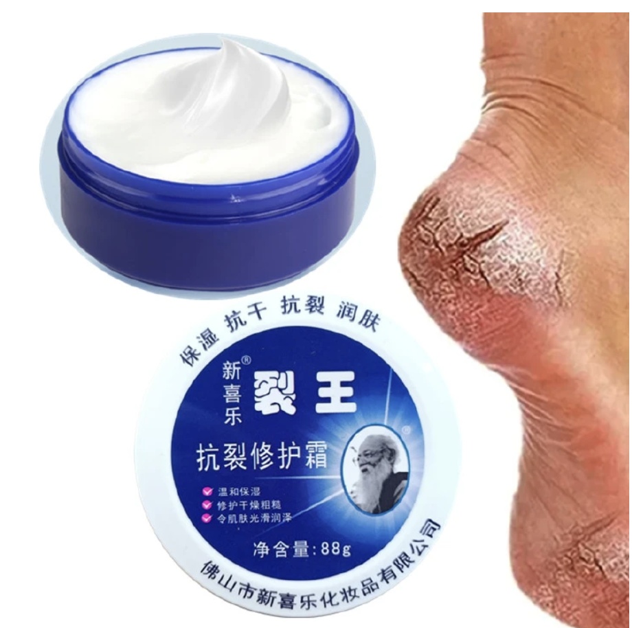 Anti-Crack Repair Cream 88g Moisturizing Anti-Dry Hand, Foot and Heel Crack King Cream Face Cream Blue 88g