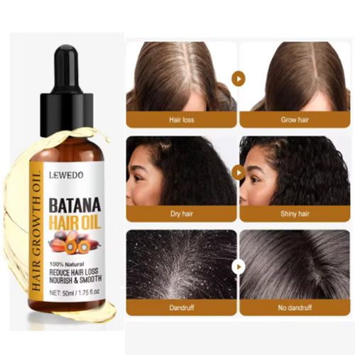Batana Oil 100% Pure African Hair Growth Oil Batana Hair Growth Mask Butter Anti Hair Loss Break Black Hair Regrowth Treatment