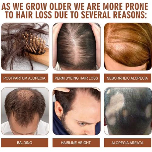 Batana Oil Hair Mask 100% Pure Organic Batana Hair Oil Anti-breakage ,nourishing,damaged Hair Repaired Natural Hair Care Set Good Quality