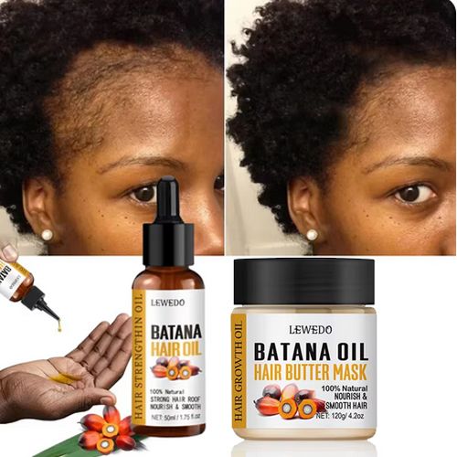 2PCS Fast Hair Growth Oil Africa Crazy Traction Alopecia batana Hair Mask Anti Hair Break Hair Strengthener Hair Loss Treatment Spray
