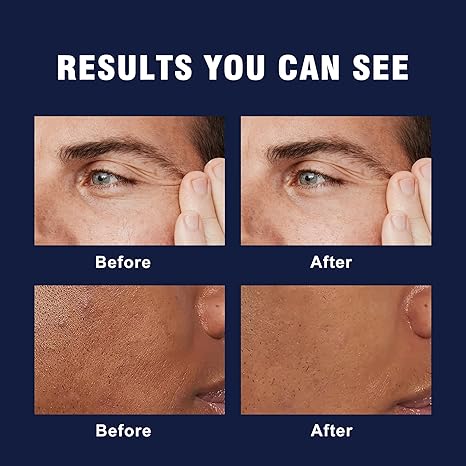 6-in-1 Face Cream for Men – Mens Anti Aging Face Cream w/Caffeine & Retinol to Firm, Hydrate & Refresh Skin, Quick-Absorbing Non-Greasy Formula