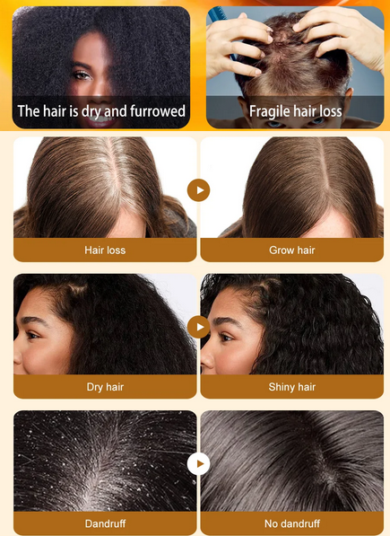 4PCS--100% Batana Hair Fast Growth Oil Set African Crazy Traction Alopecia Batana Hair Mask Anti Hair Break Hair Regrowth Treatment