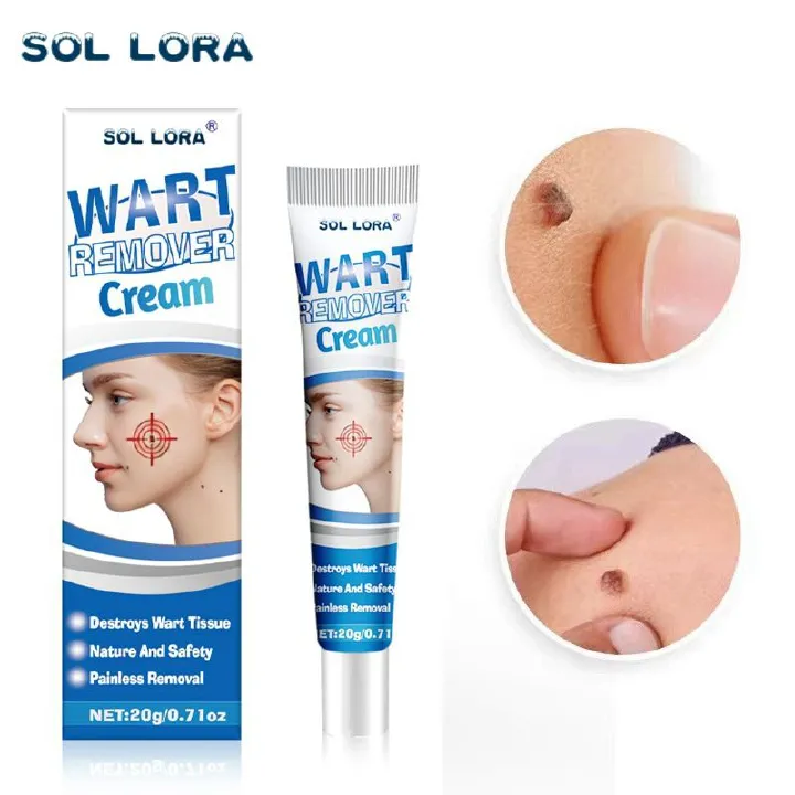 Warts Remover Antibacterial Ointment Wart Treatment Cream Skin Tag Remover Wart removal cream, wart flattening corns cream, flat warts, warts, corns and moles cream