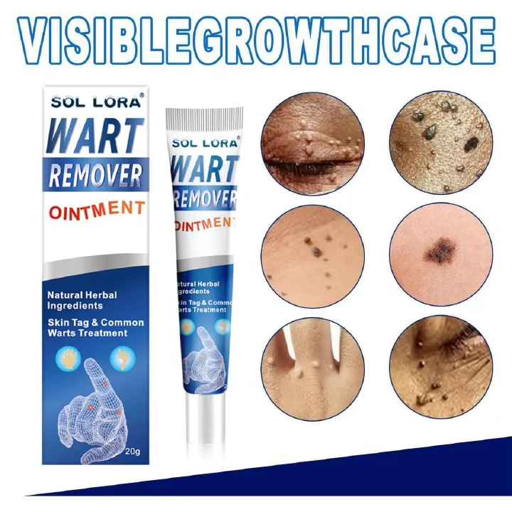 Warts Remover Antibacterial Ointment Wart Treatment Cream Skin Tag Remover Wart removal cream, wart flattening corns cream, flat warts, warts, corns and moles cream
