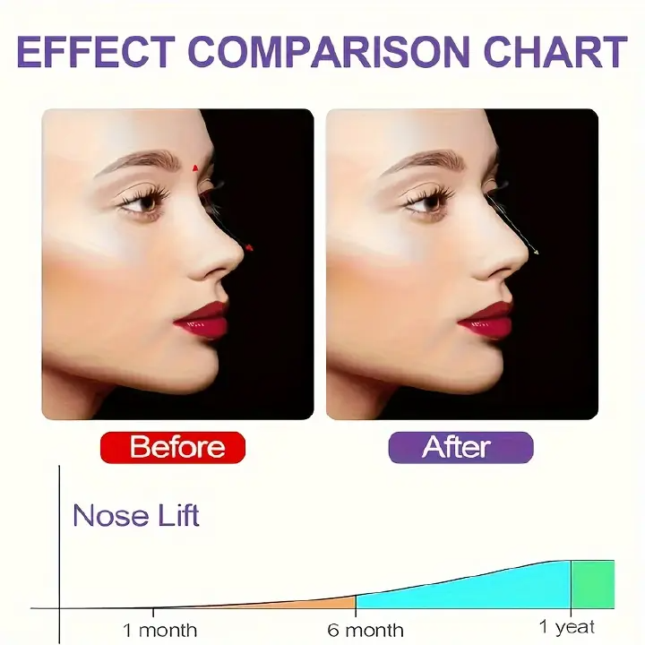Nose Shaper Clips - Straighten & Lift Your Bridge for a Clearer, More Defined Look, Battery-Free Beauty Tool