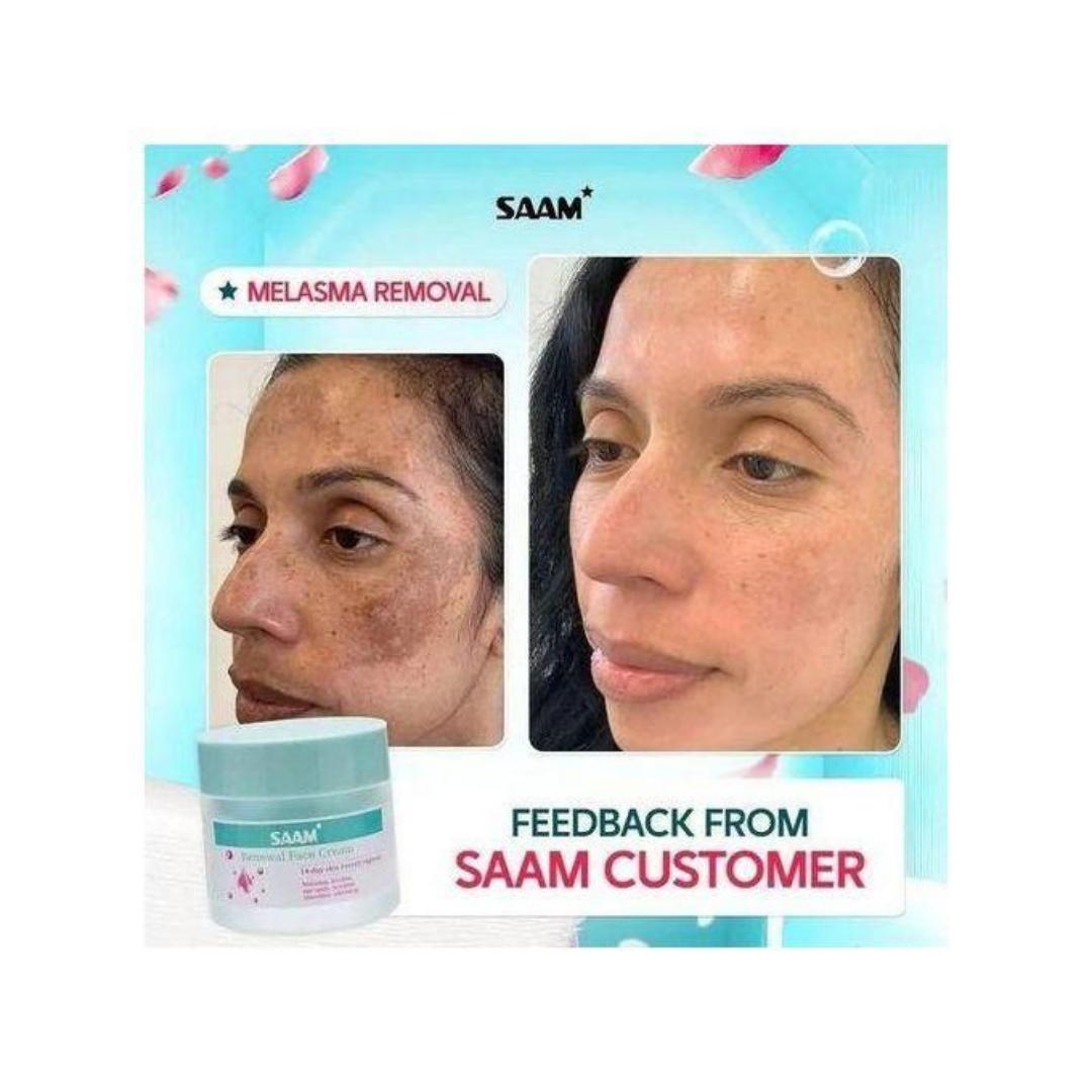 New Renewal Face Cream Age Spots & Dark Spots Removal Face Cream 50g