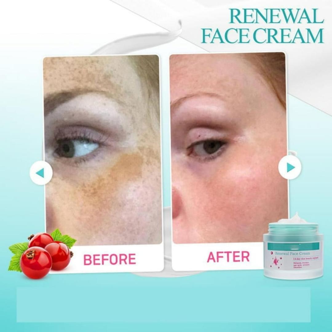 New Renewal Face Cream Age Spots & Dark Spots Removal Face Cream 50g