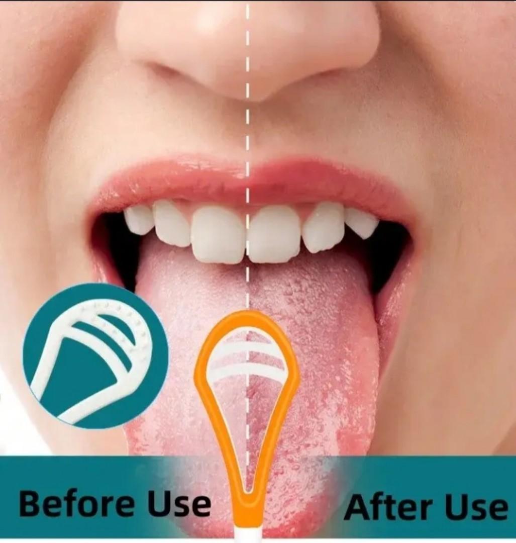 Tongue scraper, suitable for adults and children, provides healthy oral care, is easy to use, and helps combat bad breath. Travel portable cleaner Tongue coating cleaning brush