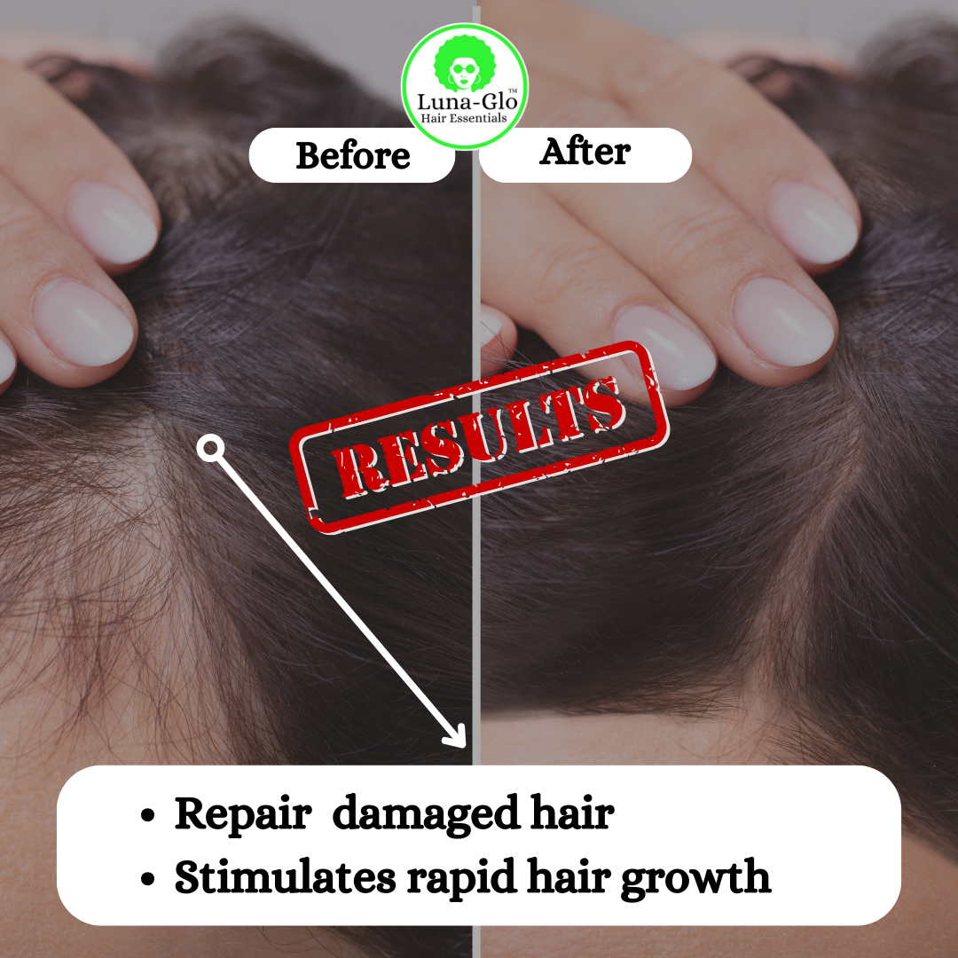 Luna-Glo's Batana Oil for Hair Growth - 100% Pure,Faster Hair Growth,Repairs Damage,Prevents Hair Loss,Delays Graying