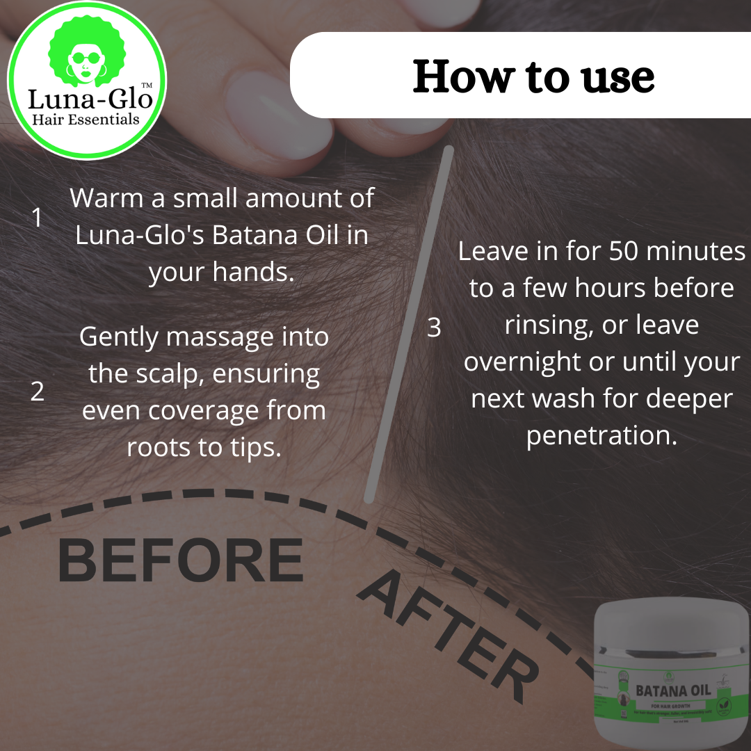 Luna-Glo's Batana Oil for Hair Growth - 100% Pure,Faster Hair Growth,Repairs Damage,Prevents Hair Loss,Delays Graying