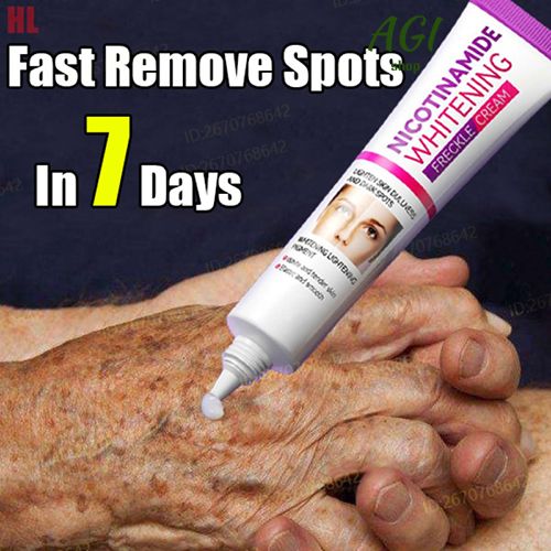 Face Skin Care Set Nicotinamide Whitening Freckles Cream + Facial Cleanser + Moisturizing lotion + Face Essence + Face Toner + Masks 5 Pcs  Remove Melasma Dark Spot Acne Marks Brightening Skin Tone