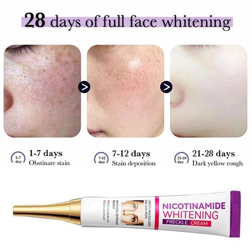 Face Skin Care Set Nicotinamide Whitening Freckles Cream + Facial Cleanser + Moisturizing lotion + Face Essence + Face Toner + Masks 5 Pcs  Remove Melasma Dark Spot Acne Marks Brightening Skin Tone