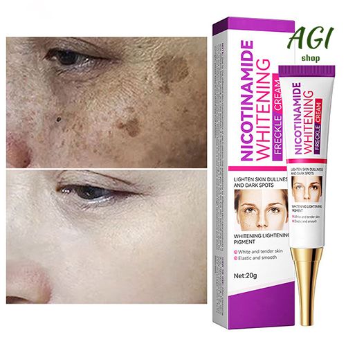 Face Skin Care Set Nicotinamide Whitening Freckles Cream + Facial Cleanser + Moisturizing lotion + Face Essence + Face Toner + Masks 5 Pcs  Remove Melasma Dark Spot Acne Marks Brightening Skin Tone