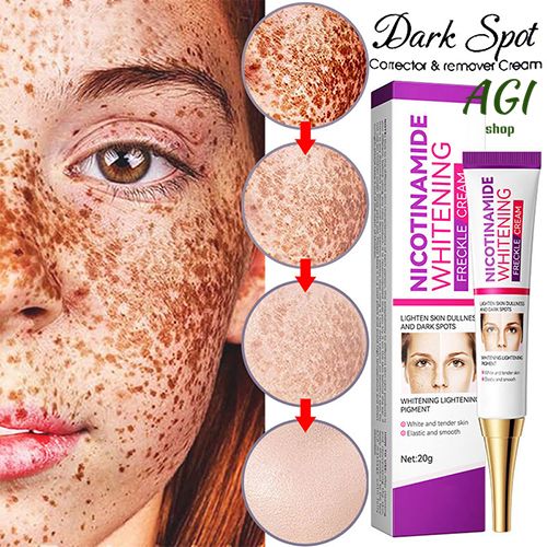 Face Skin Care Set Nicotinamide Whitening Freckles Cream + Facial Cleanser + Moisturizing lotion + Face Essence + Face Toner + Masks 5 Pcs  Remove Melasma Dark Spot Acne Marks Brightening Skin Tone