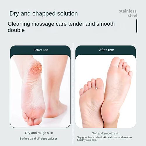 1pcs Double Side Foot File Heel Grater Hard Dead Skin Callus Professional Rasp Remover Stainless Steel Foot Pedicure Tools