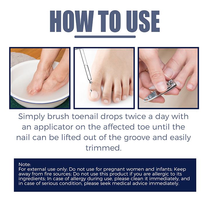 Toenail Nail Fungus Treatment Repair Fingernail Device Toenail Treatment for Foot Nail Fungus Essential Oil Onychomycosis Care