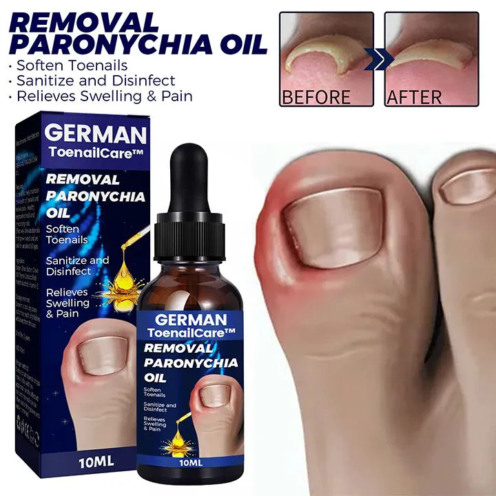 Toenail Nail Fungus Treatment Repair Fingernail Device Toenail Treatment for Foot Nail Fungus Essential Oil Onychomycosis Care