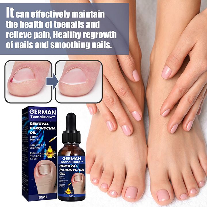 Toenail Nail Fungus Treatment Repair Fingernail Device Toenail Treatment for Foot Nail Fungus Essential Oil Onychomycosis Care
