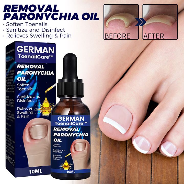 Toenail Nail Fungus Treatment Repair Fingernail Device Toenail Treatment for Foot Nail Fungus Essential Oil Onychomycosis Care