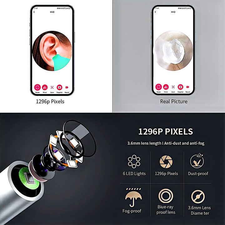 Smart Visual Ear Cleaner with Camera 1296P Ear Sticks USB C Charging Ear Wax Removal Tool WIFI Connection 6 LED Lights Earpick