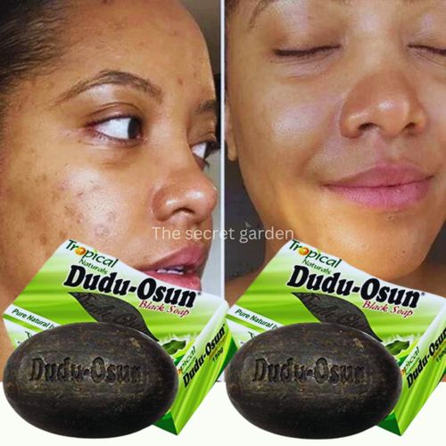 Dudu-Osun Natural African Black Soap For Pimples/Acne/Rashes/Psoriasis/Eczema