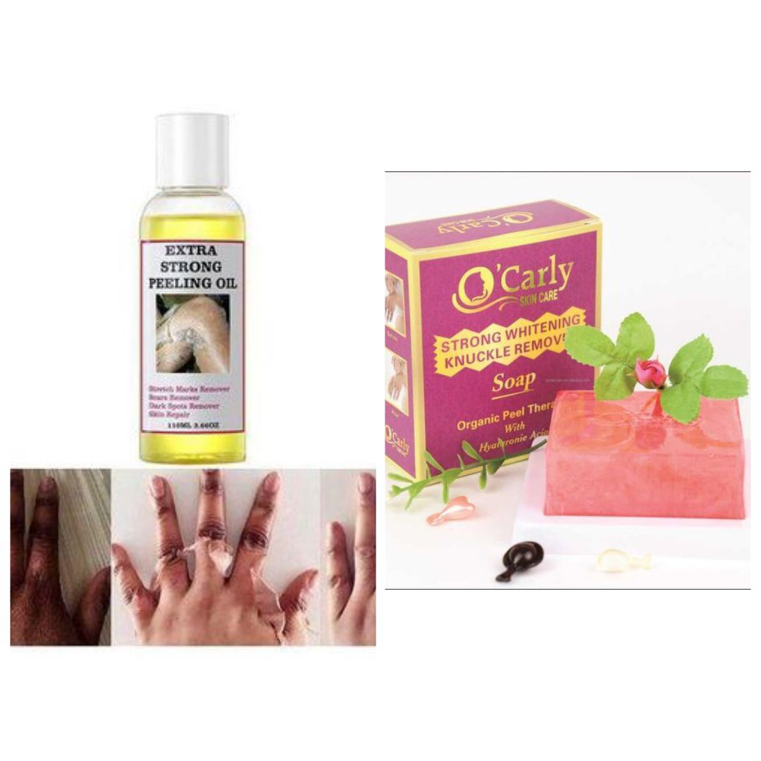 Extra Strong Peeling Oil Elbows Knees Hands Even Complexion + O'Carly Strong Knuckle Lightening Soap