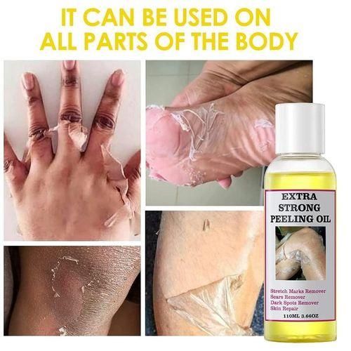 Extra Strong Peeling Oil Elbows Knees Hands Even Complexion + O'Carly Strong Knuckle Lightening Soap