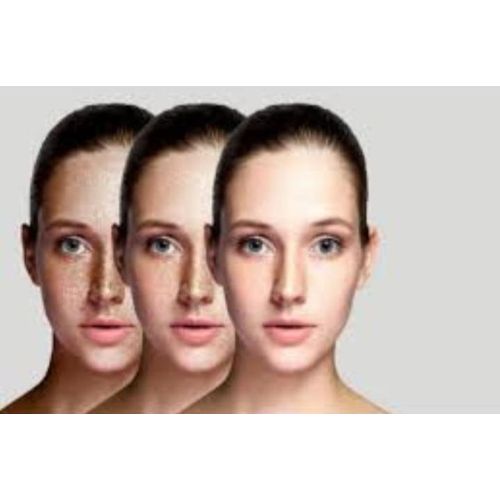 Chandni Whitening Cream-Removes Acne,Pimples,Dark Spots & wrinkles.  restores natural freshness & beauty of the skin