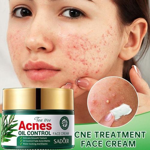 SADOER Acnes Oil Control Face Cream - Heals Acne, Fades Acne Marks, Soothes, Repairs, Moisturizes, Makes Skin Elastic - Tea Tree Acne Oil Control For Moisturizing, Repair, Water locking