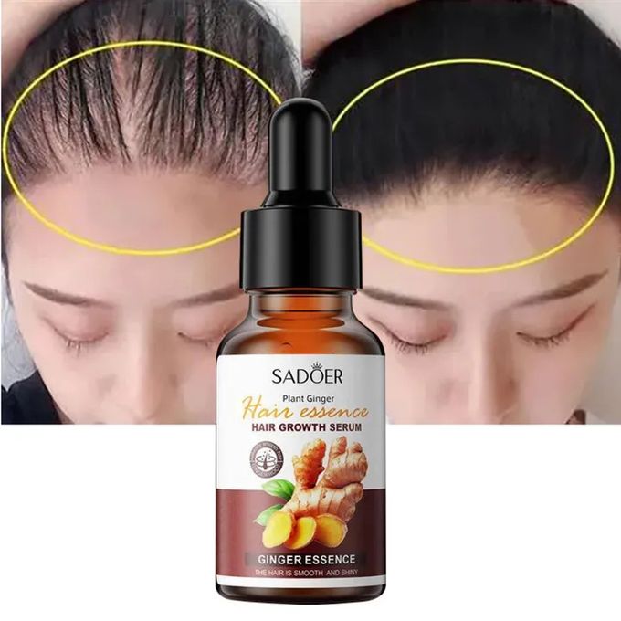 Sadoer 2 Pieces Ginger Hair Growth Serum + Anti Hair Loss Treatment Serum , Restores Lush Hair , Treat Alopecia, Effective in Hair Growth,Moisturizing and Softening Forked Hair, with ScalpCare