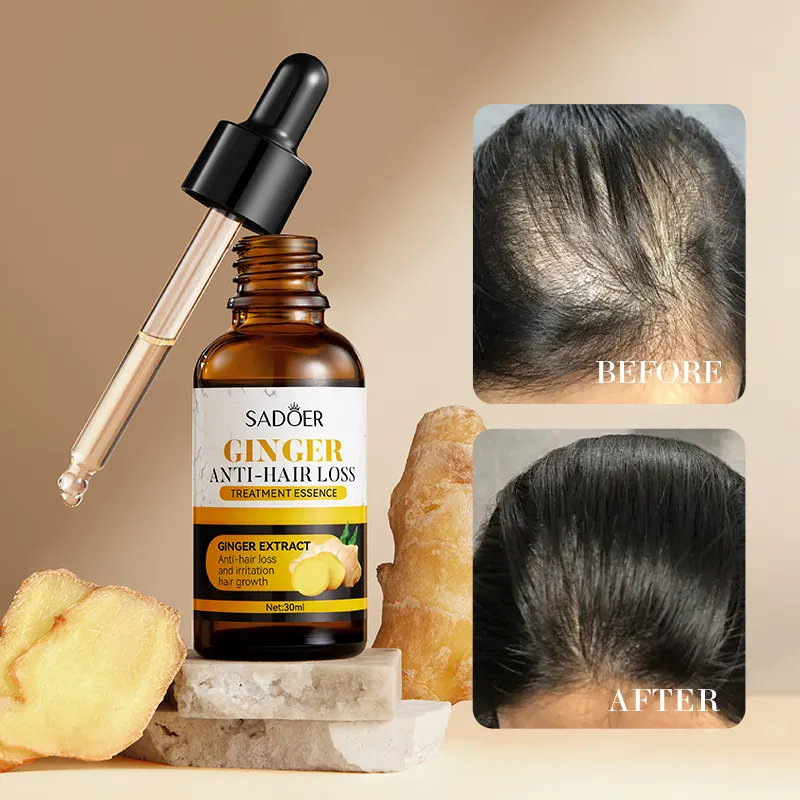 Sadoer 2 Pieces Ginger Hair Growth Serum + Anti Hair Loss Treatment Serum , Restores Lush Hair , Treat Alopecia, Effective in Hair Growth,Moisturizing and Softening Forked Hair, with ScalpCare