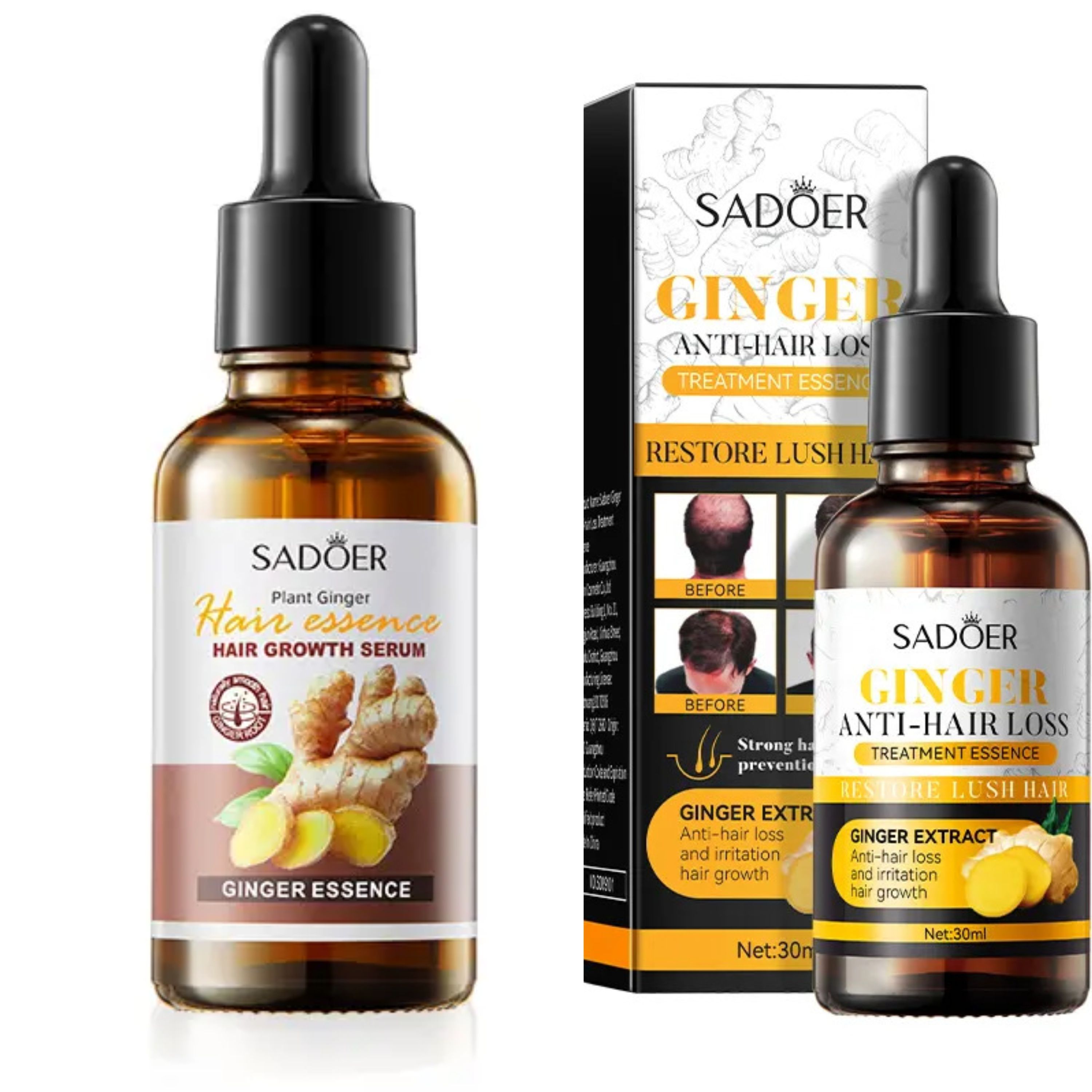 Sadoer 2 Pieces Ginger Hair Growth Serum + Anti Hair Loss Treatment Serum , Restores Lush Hair , Treat Alopecia, Effective in Hair Growth,Moisturizing and Softening Forked Hair, with ScalpCare